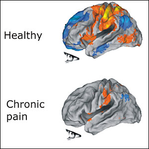 chronic pain management in Vancouver, chronic pain management Vancouver BC